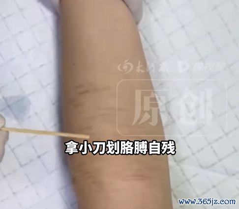 高三女生高考前表白被拒自残住院 医师判断：是失恋导致的情谊波动和自我怀疑